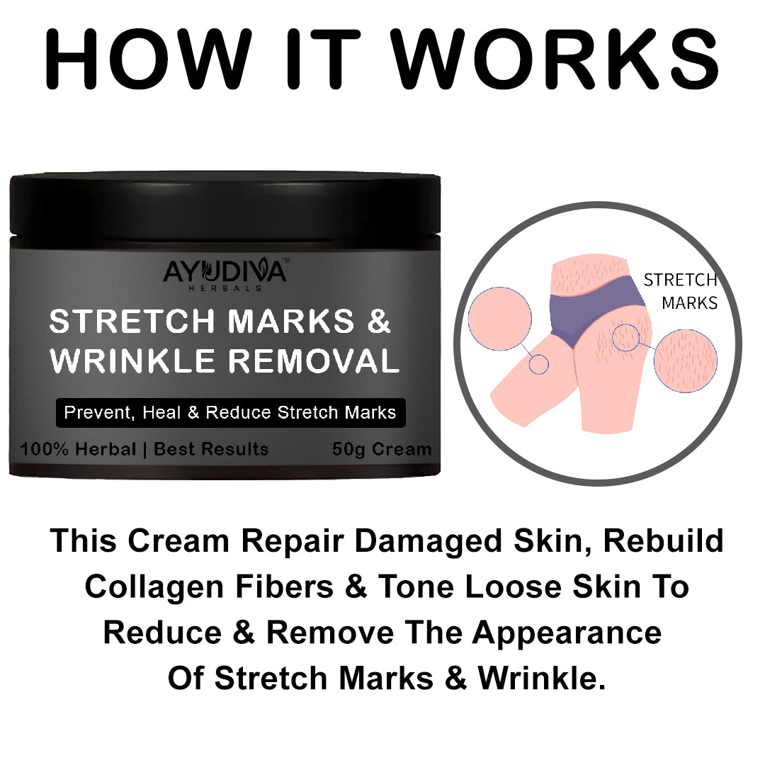 Ayudiva Herbals Stretch Marks & Wrinkle Removal Cream